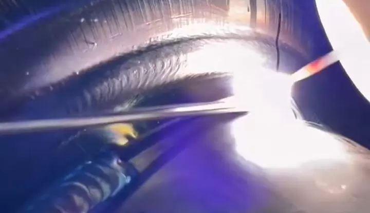 TIG-keevitus